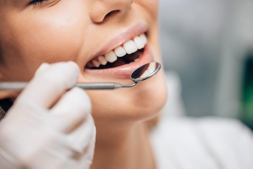 Carillas dentales en Culleredo