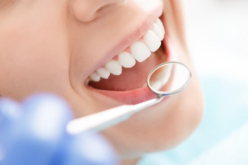 Preventiva