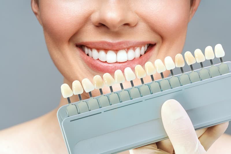 Estética dental