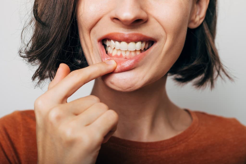 Periodoncia en Culleredo
