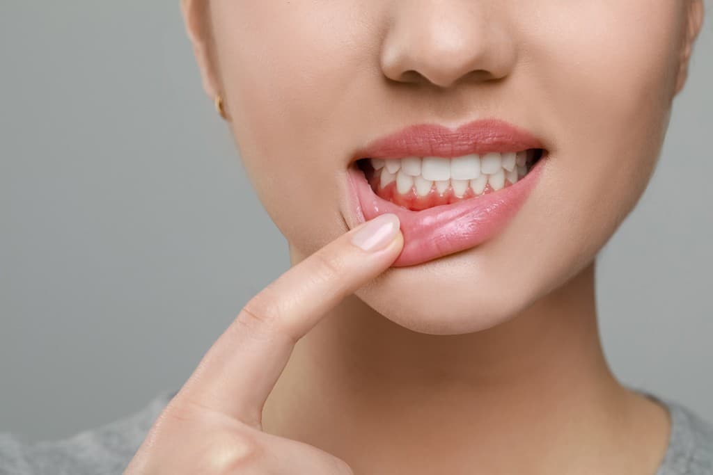 Periodontitis en Culleredo