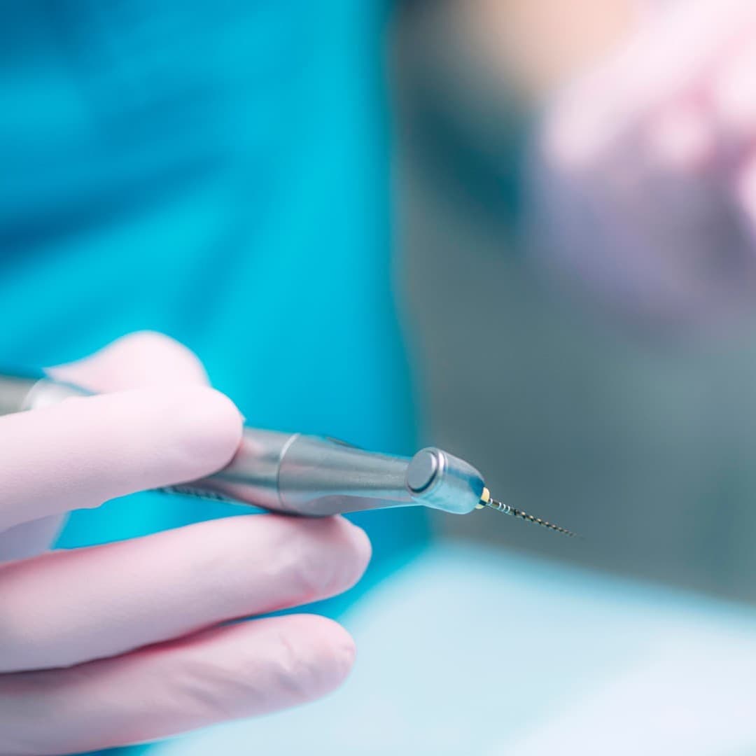 Endodoncia en Culleredo