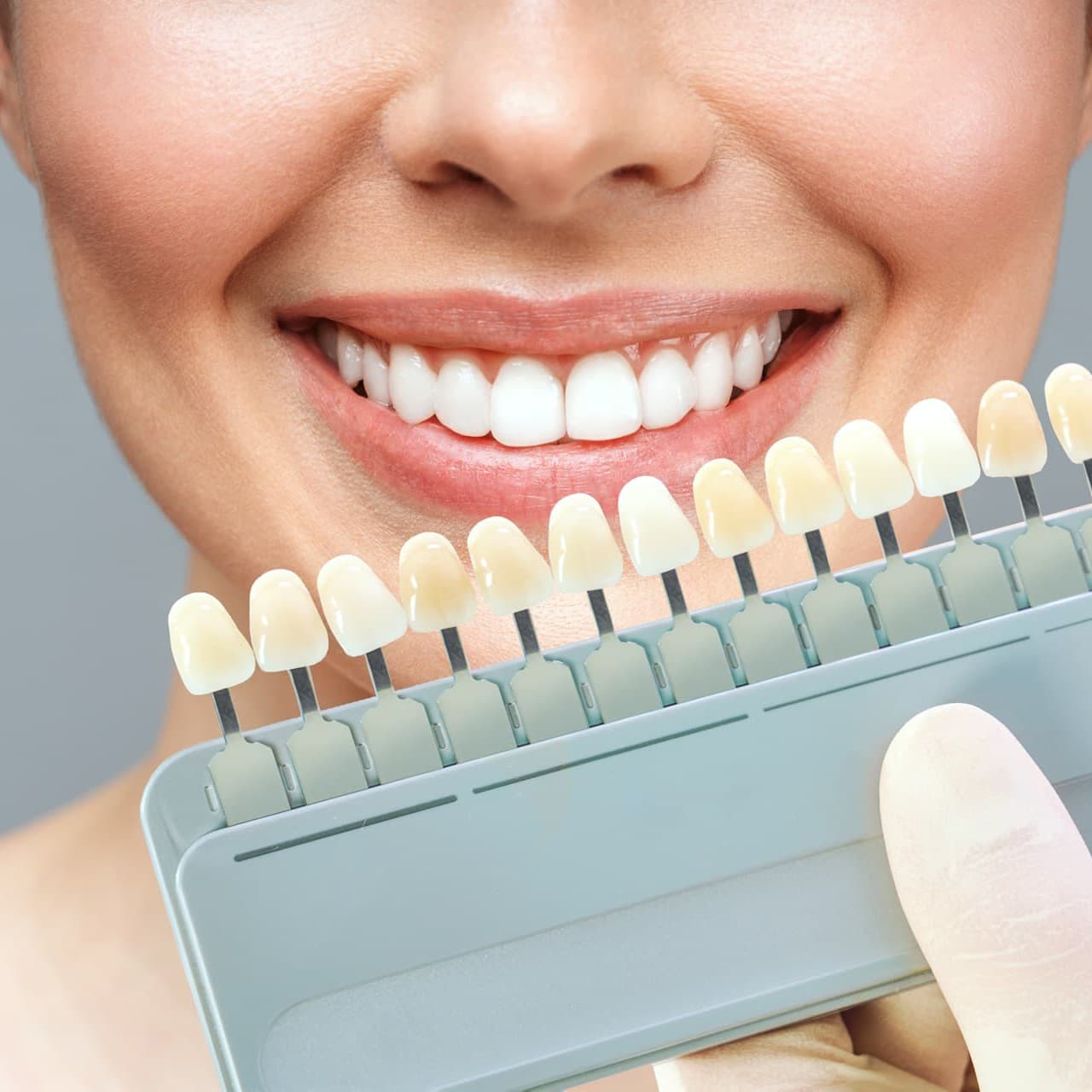 Estética dental en Culleredo