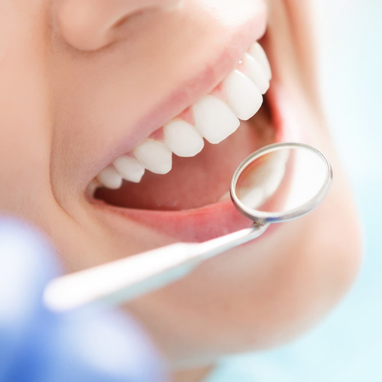 Odontología preventiva en Culleredo